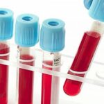 Ученый объяснил связь коронавируса с группой крови