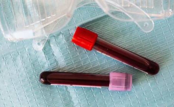 В Британии начнут использовать анализ крови для ранней диагностики более 50 видов рака