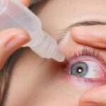 Зудит и режет: как распознать синдром сухого глаза?