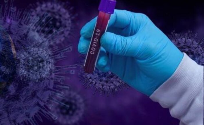 Российские ученые нашли оригинальный способ убить коронавирус