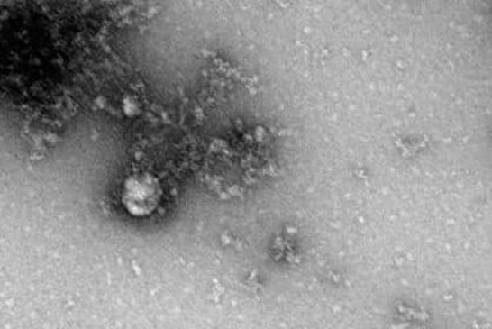 Ученые объяснили, чем опасен «британский» штамм коронавируса