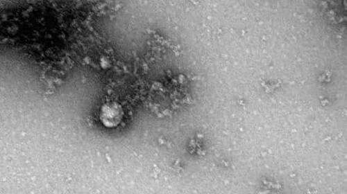 Ученые объяснили, почему «британский» штамм коронавируса такой заразный