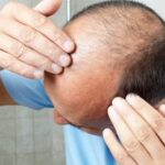 Ученые объяснили, с чем связано выпадение волос при стрессе