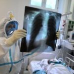 Легкие поражены, кислород в норме: врач объяснил парадокс коронавируса