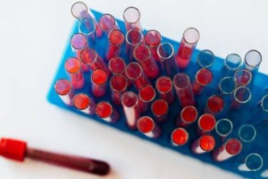 Ученые нашли новые связи между группой крови и риском некоторых болезней