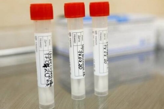 Смерть пациентки от инсульта связали с вакциной AstraZeneca от коронавируса