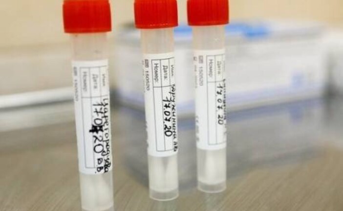 Смерть пациентки от инсульта связали с вакциной AstraZeneca от коронавируса
