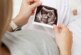 Фертильность у женщин: как рассчитать лучший день для зачатия ребенка