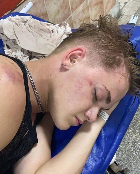 Появилось видео избиения танцора Нади Дорофеевой, который впал в кому | StarHit.ru