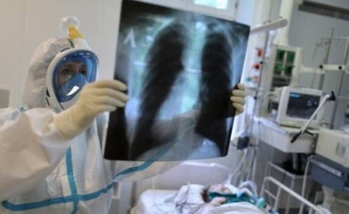 Врач-рентгенолог разбил тезис о «нормальности» состояния при значительном поражении легких