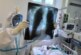 Врач-рентгенолог разбил тезис о «нормальности» состояния при значительном поражении легких