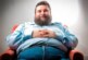 Особые гены защищают людей с ожирением от ряда болезней