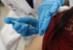 Российские биотехнологи придумали вакцину от коронавируса с белком сальмонеллы