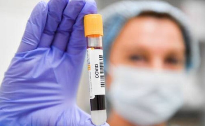 Выяснилось, где в России сделали больше всего тестов на коронавирус